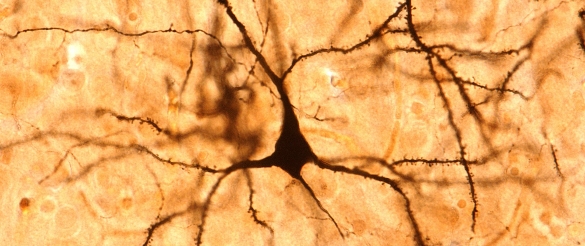 Mikroskopische Darstellung einer Nervenzelle mit verzweigten Dendriten.